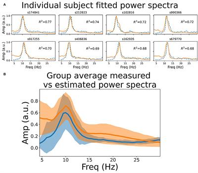 A Connectome-Based, Corticothalamic Model of State- and Stimulation-Dependent Modulation of Rhythmic Neural Activity and Connectivity